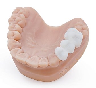 Фотополимерная смола HARZ Labs Dental Bleach, белый (1000 гр)