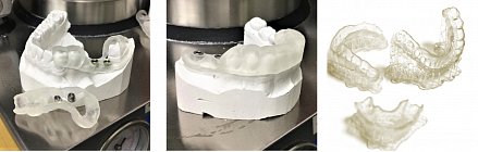 Фотополимер HARZ Labs Dental Clear Form2, прозрачный (1 кг)