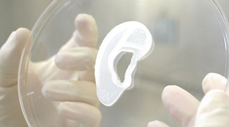 Первая успешная имплантация человеческого уха, напечатанного на 3D принтере, открывает новые горизонты в медицине